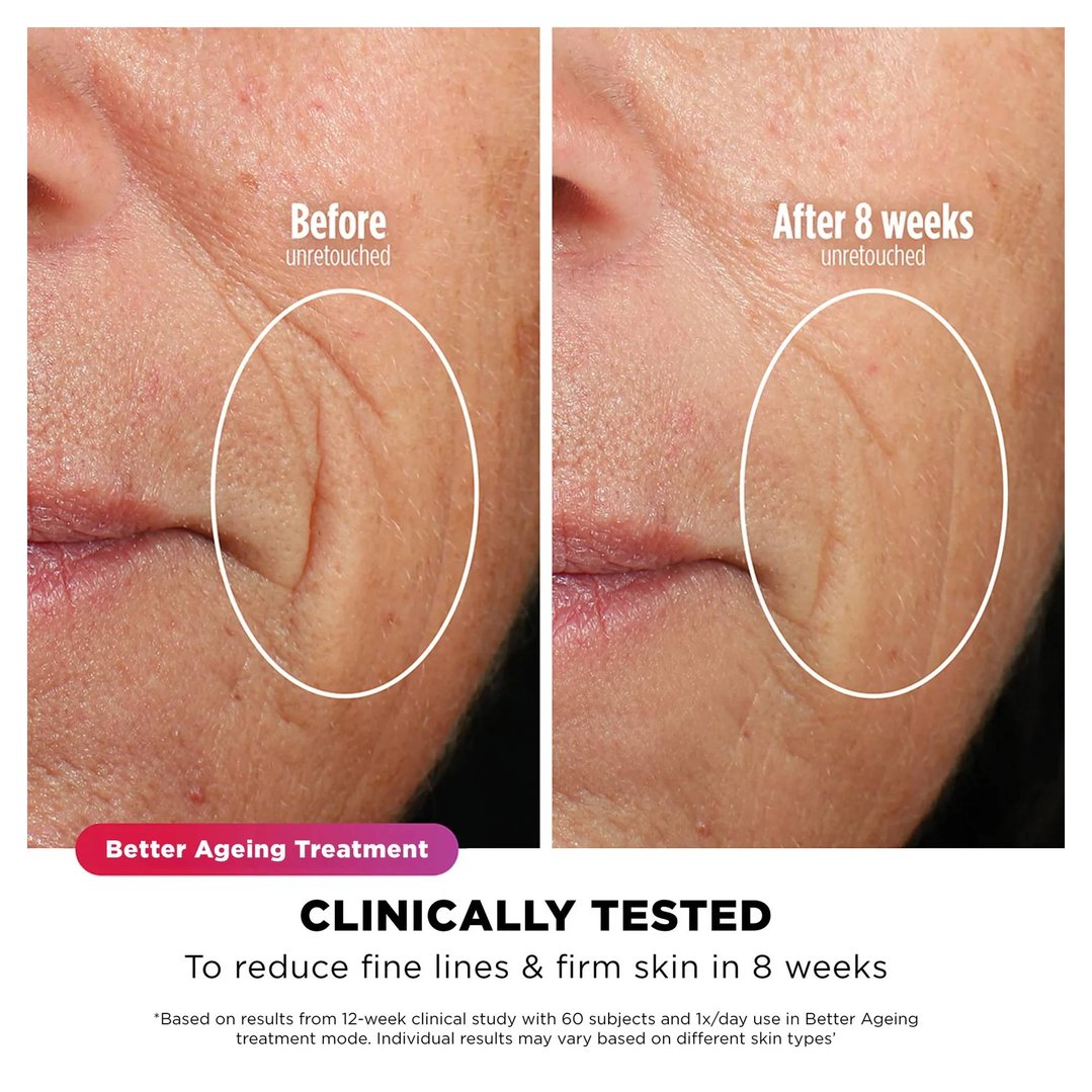 Shark CryoGlow Under-Eye Cooling + LED Face Mask - Lilac FW312PL