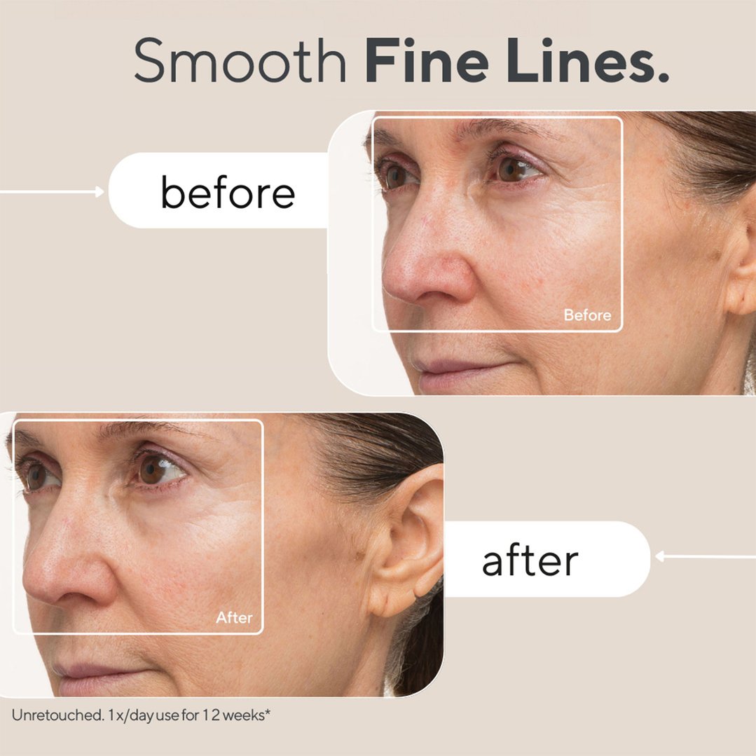 Therabody TheraFace Mask - Advanced, Clinically Proven LED Light Mask With Massage and 648 LEDs TF03991-01