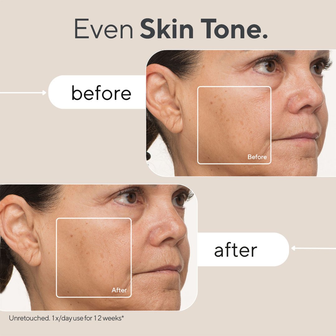 Therabody TheraFace Mask - Advanced, Clinically Proven LED Light Mask With Massage and 648 LEDs TF03991-01